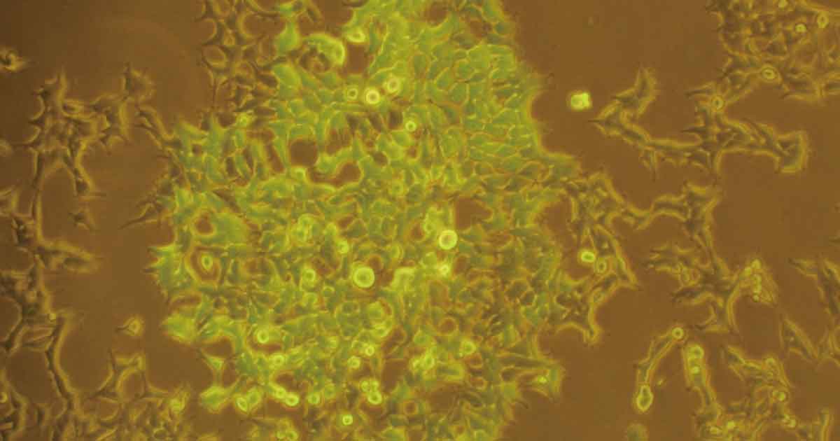 /images/news/20250305_news_GFPCell.jpg