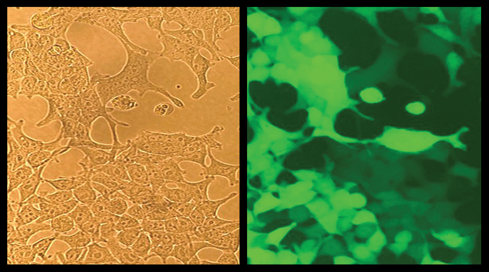 Brightfield and GFP observation comparison using ULFAS