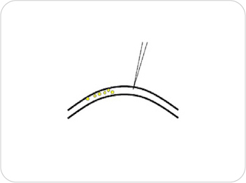 GONAD-step2